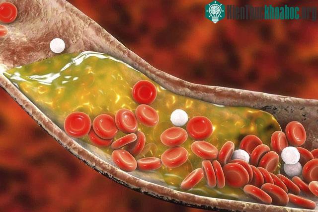 Cơ thể người có sẵn loại enzym giúp ăn mãi không béo, cách "kích hoạt" nó thế nào? ảnh 1