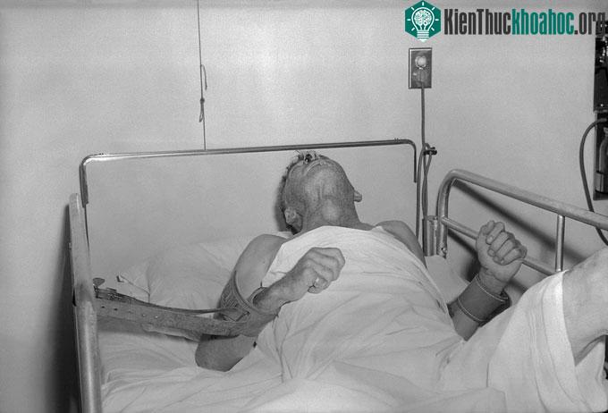 Bệnh nhân lên cơn dại.