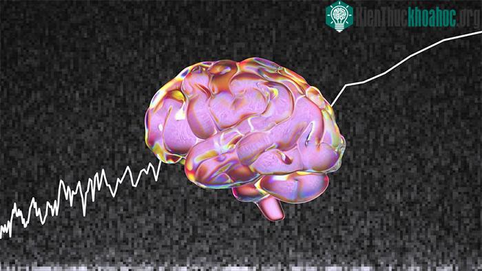 Mô hình AI này có tên là Mind-Vis