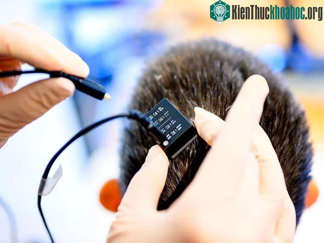Người bị liệt có thể nói chuyện nhờ công nghệ dịch tín hiệu não.