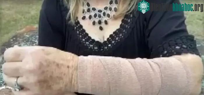 Hậu quả của vụ việc bị cả rắn lẫn diều hâu tấn công.