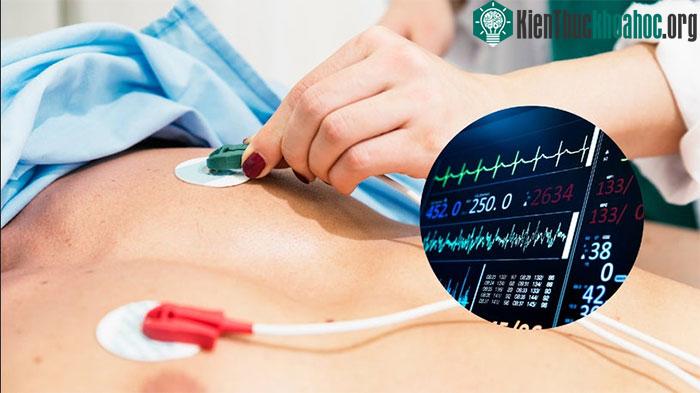 Nhồi máu cơ tim là một bệnh lý tim mạch nguy hiểm và có tỷ lệ tử vong cao.
