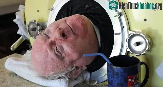 Ông Paul Alexander được đặt biệt danh "Paul bại liệt".