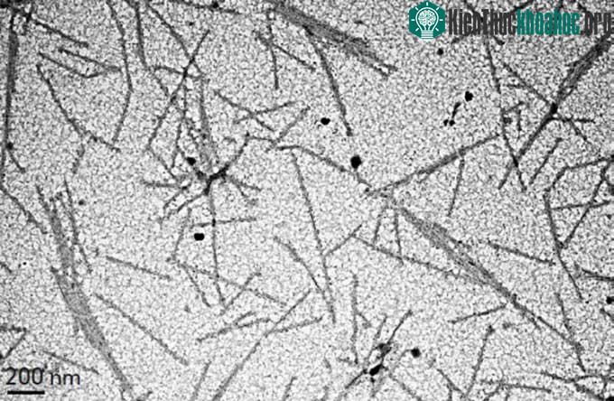 Virus khảm thuốc lá dưới kính hiển vi điện tử truyền qua (TEM).