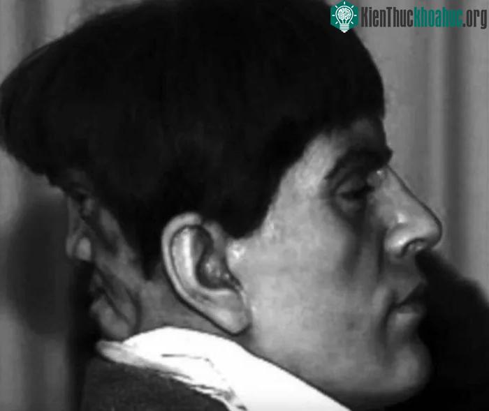 Tượng sáp mô phỏng hình ảnh của Edward Mordrake.