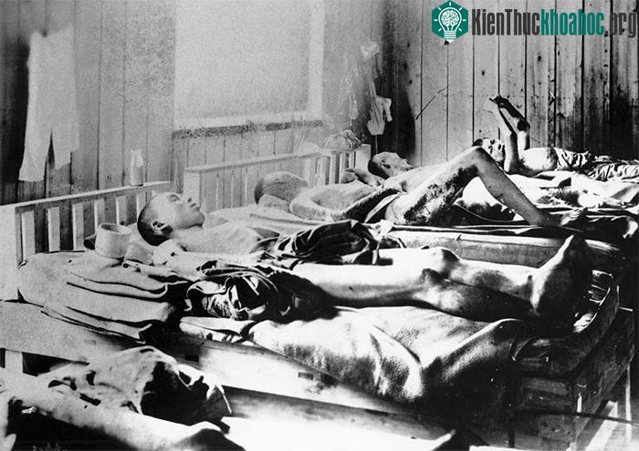 Những người may mắn sống sót sau vụ đánh bom ở Hiroshima