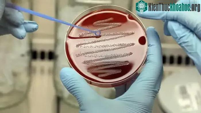 Lạm dụng thuốc kháng sinh là nguyên nhân chính gây ra hiện tượng AMR.