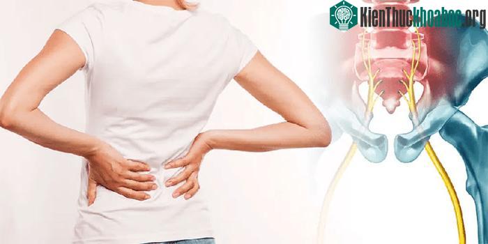 Đau thần kinh tọa có thể xảy ra ở hầu hết mọi nơi dọc theo đường dẫn truyền thần kinh.
