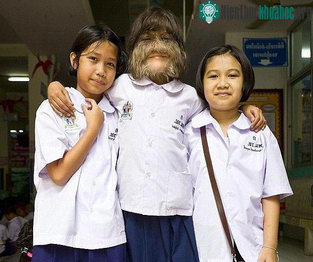 Bị tẩy chay và trêu chọc nhưng Natty vẫn mạnh mẽ vượt qua