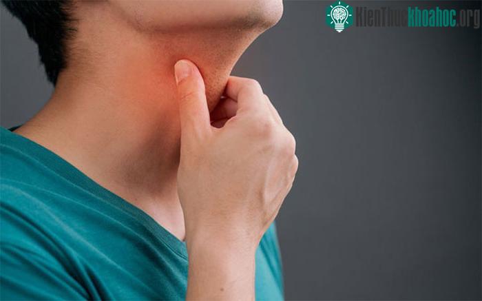Bệnh cúm mùa rất khó phân biệt với các bệnh đường hô hấp khác