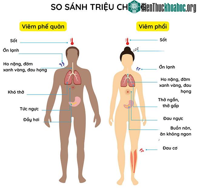 Phân biệt triệu chứng viêm phế quản và viêm phổi