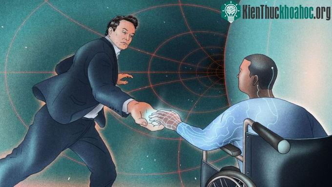 Minh họa chip não Neuralink có thể hỗ trợ bệnh nhân ngồi xe lăn