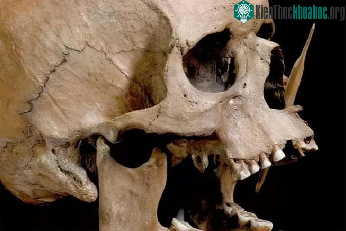 Hộp sọ minh chứng cho thấy sự tàn bạo của những cuộc tiếp quản đẫm máu