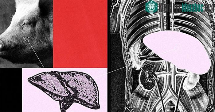Gan heo có thể là giải pháp “cầu nối” cấy ghép cho bệnh nhân gan
