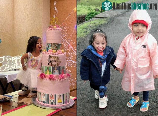 Vì ngoại hình thấp bé, cô gái không thể ra ngoài một mình, người khác sẽ có thể dẫm phải cô