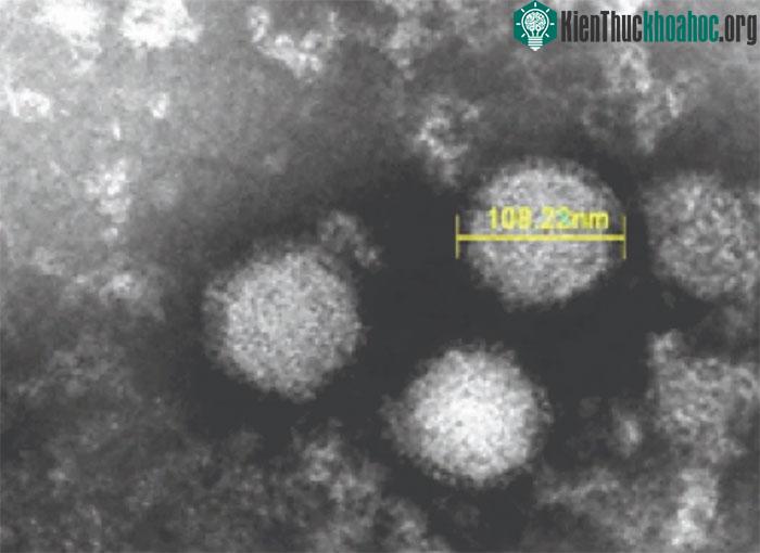 Sốt giảm tiểu cầu là một bệnh truyền nhiễm do bọ ve mang virus SFTS đốt.