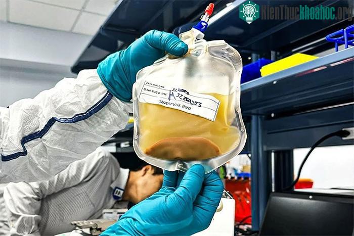 Túi tiêm tĩnh mạch chứa các tế bào gan