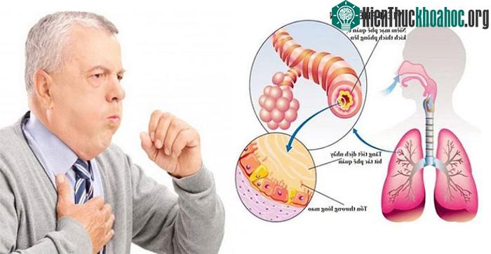 Top 5 giải pháp giảm khó thở do không khí lạnh tăng cường ảnh 0