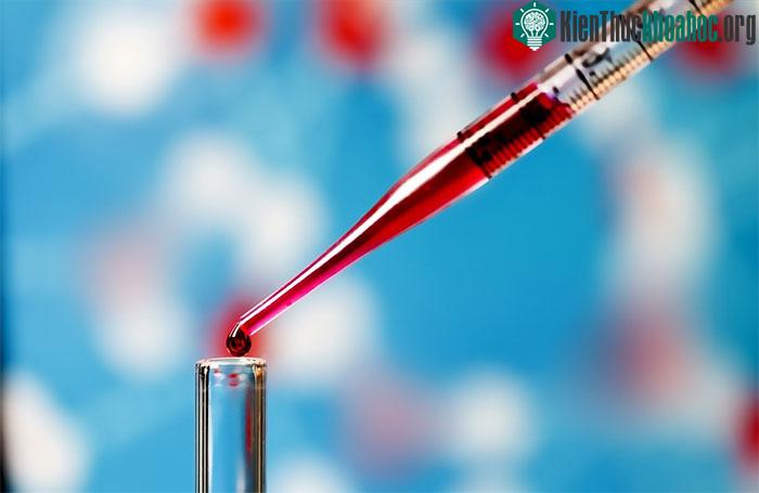 &nbsp;Xét nghiệm máu xác định bệnh Alzheimer do nhóm HKUST phát triển rất đơn giản, hiệu quả.