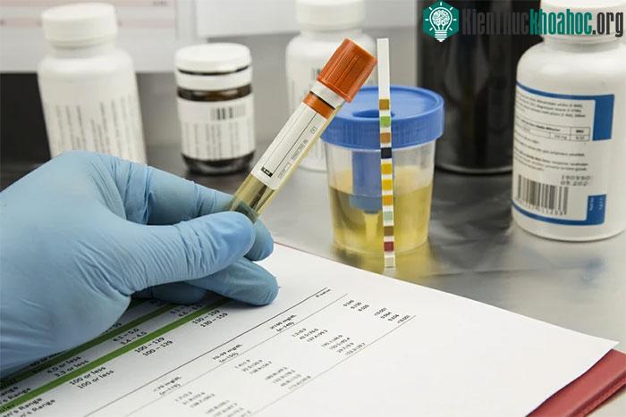 Xét nghiệm cho kết quả sau 3 phút giúp đẩy nhanh quá trình điều tra.