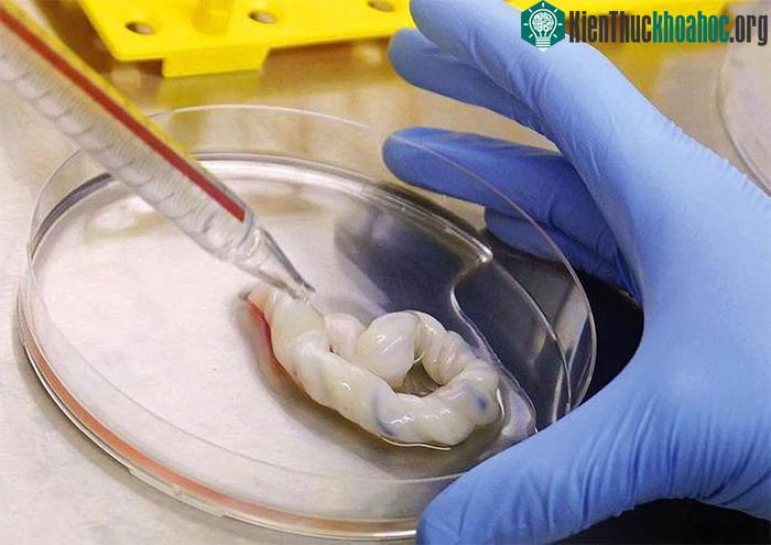 Tế bào gốc máu cuống rốn giúp điều trị nhiều căn bệnh hiểm nghèo.