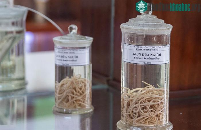 Búi giun đũa người với số lượng lên đến hàng trăm con được phát hiện và thu thập năm 1998.