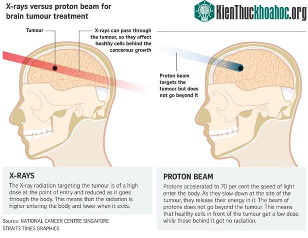 So sánh đường đi của chùm tia trong phương pháp xạ trị thông thường và phương pháp Proton.