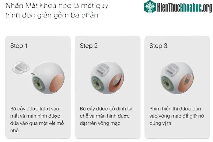Quá trình lắp "mắt khoa học".