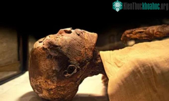 Sự thật về khả năng truyền bệnh của vi khuẩn xác ướp ảnh 0