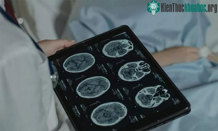 Các nhà khoa học đã tìm ra cách khiến tế bào ung thư tự hủy mà không cần dùng thuốc.