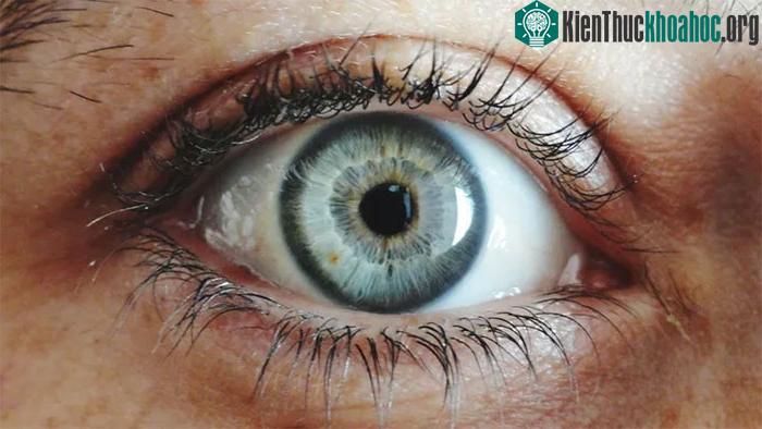 Giờ đây, xám mới được công nhận là màu mắt hiếm nhất