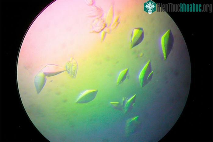 Một loại protein sửa chữa DNA có thể mở ra tiềm năng cho vaccine trị ung thư