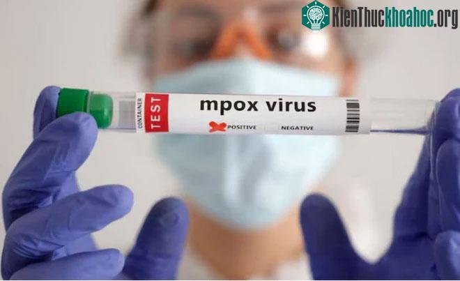 Nhiều nước ở châu Phi cũng không có đủ trang thiết bị cần thiết để theo dõi và giám sát dịch