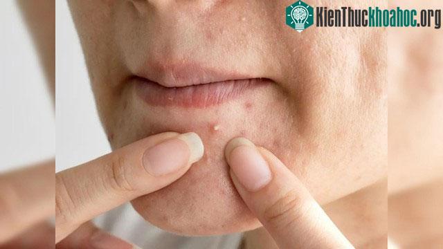 &nbsp;Duy trì một lối sống lành mạnh vẫn là yếu tố quan trọng trong việc giữ gìn vẻ ngoài trẻ trung.
