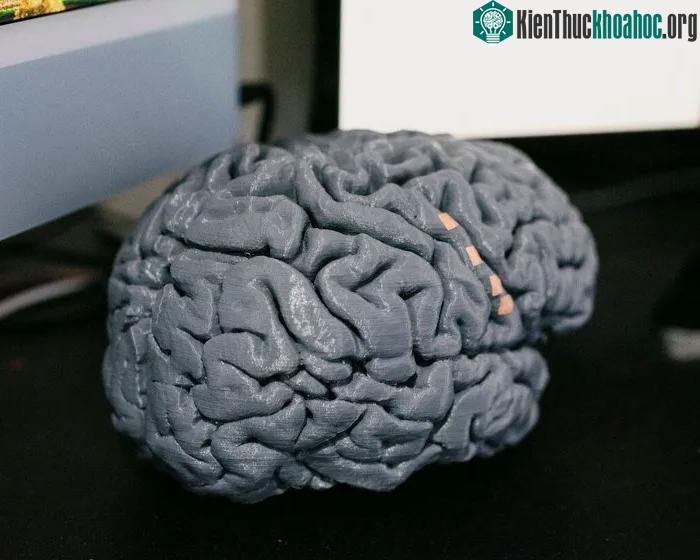 Bản in 3D não của Harrell, giúp các nhà khoa học tinh chỉnh thiết bị cấy ghép.