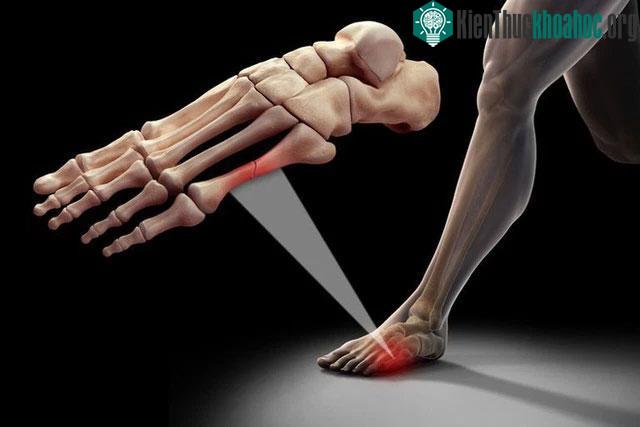 Người châu Á, cụ thể là Trung Quốc có ít xương hơn người châu Âu, châu Mỹ.