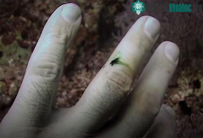 Máu có màu xanh lục của một thợ lặn bị cá chình Moray cắn