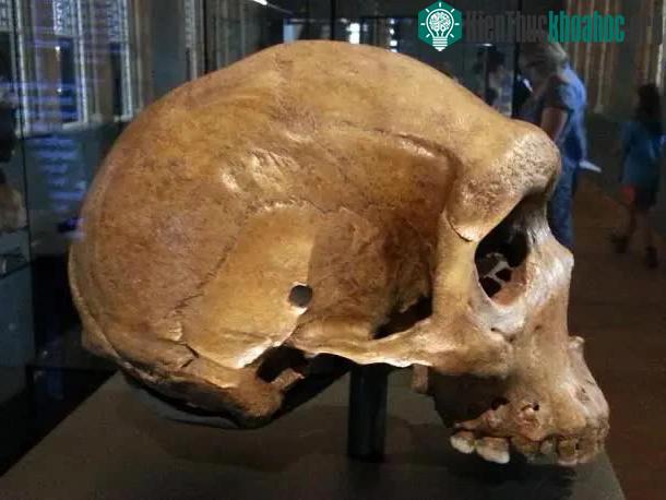 Tại sao lại có lỗ đạn xuất hiện trên các hộp sọ tiền sử? ảnh 0