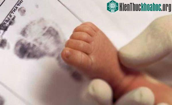 Dấu vân chân của trẻ sẽ được lấy và lưu giữ lại tại bệnh viện.