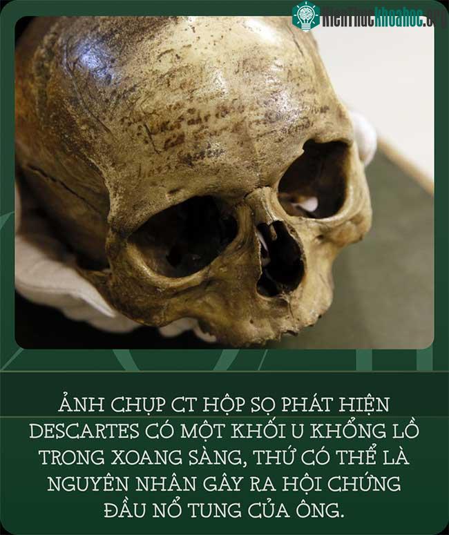 Hộp sọ của Descartes