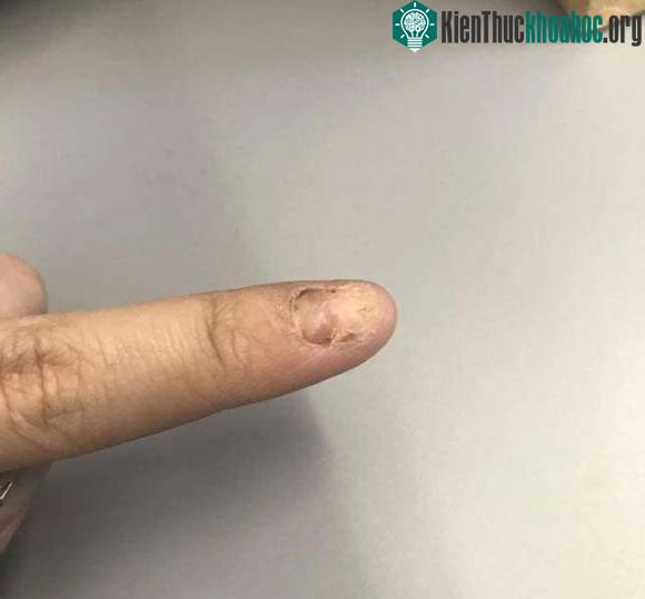 Các phi hành gia sẽ nhổ hết móng tay trước khi lên không trung.
