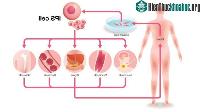 Một sơ đồ cho thấy tế bào gốc đa năng cảm ứng (iPSCs)