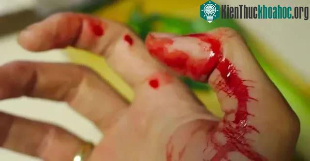 Các vết thương sẽ lâu lành hơn trong môi trường có hàm lượng oxy thấp.