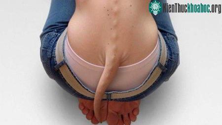 Tổ tiên ta ngày xưa có đuôi