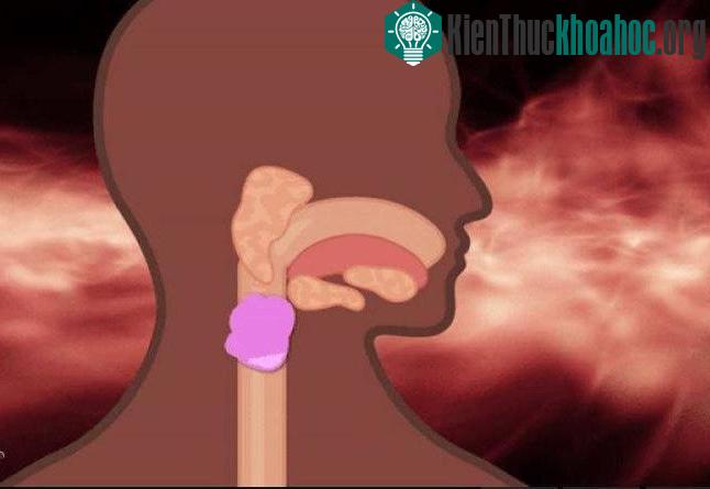 Kẹo cao su di chuyển thành khối lớn qua đường tiêu hóa nếu nuốt nhầm. (Ảnh: GIPHI).