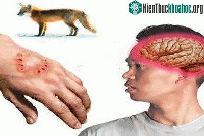 Virus dại chủ yếu lây nhiễm qua vết cắn, hoặc vết thương hở do nước bọt của chó dính vào.