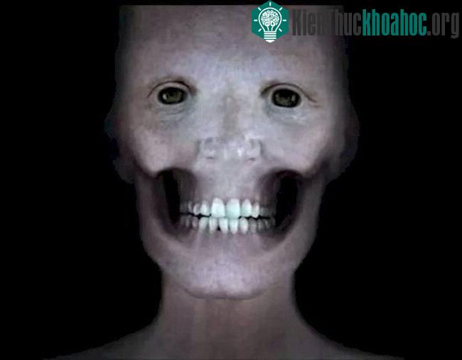 Nếu không có lớp cơ, khuôn mặt của con người trông sẽ như thế này