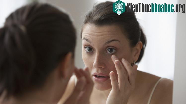 Gỉ mắt được tạo ra từ lớp ngoài cùng của màng nước mắt.