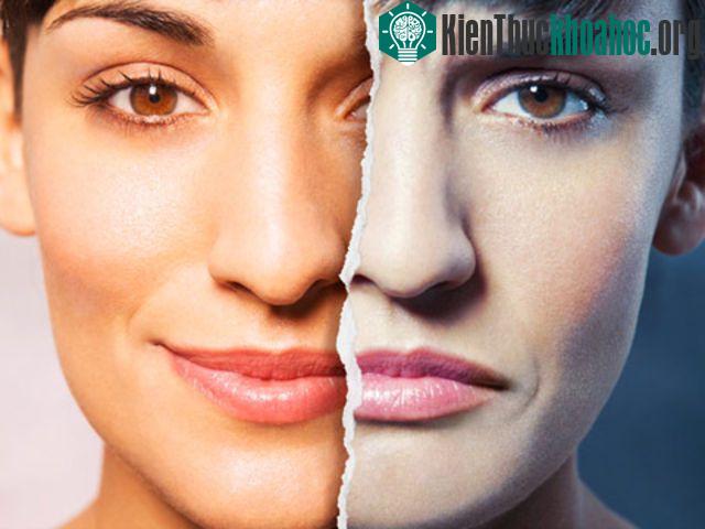 Những sinh viên có kết quả học tập cao có nguy cơ bị rối loạn lưỡng cực tăng gấp 4 lần trong đời.