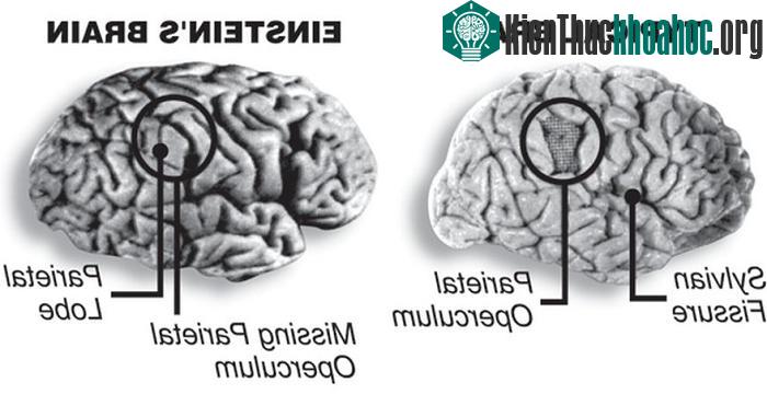Não của Albert Einstein có một thùy lớn hơn 15% so với bộ não trung bình.